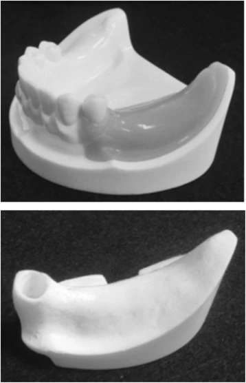 Figure 1. An artificial mandible