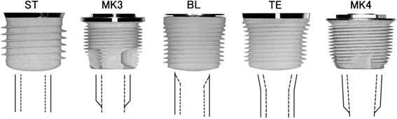 Figure 1. Compressed longitudinally to one third for characteristics of implant design. ST Straumann standard implant, MK3 Nobel Biocare MKIII, BL Straumann bone level implant, TE Straumann tapered effect implant, MK4 Nobel Biocare MKIV. Outer surface of implant (solid line). Inner surface of implant (dotted line)