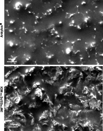 Figure 2. Implant surface characterization under SEM. Increased surface roughness in the 3M™ESPE™ MDI dental implants when compared to Ankylos® implants