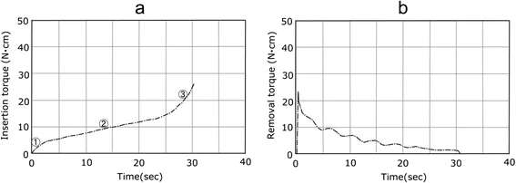 Figure 4. Torque-time curves of the TE. a Insertion torque. b Removal torque