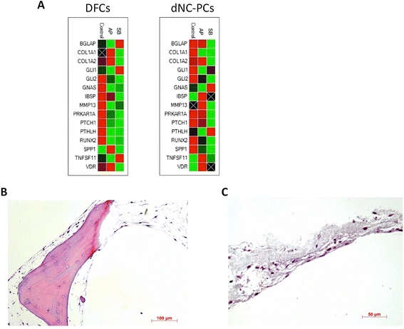 Figure 5. Evaluation of osteogenic differentiation. (A) Clustergram of PCR-array results; (B-C) histology of differentiated dental cells on AP (B) and SB (C). Representative results are shown for dNC-PCs.