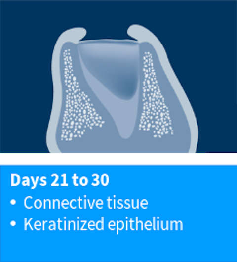 Day 21 - 30 : keratinized epithelium