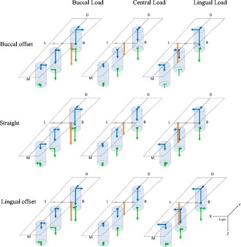 Fig. 10. The displacement of the three implants