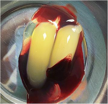 Fig. 1. CGF was obtained after centrifugation