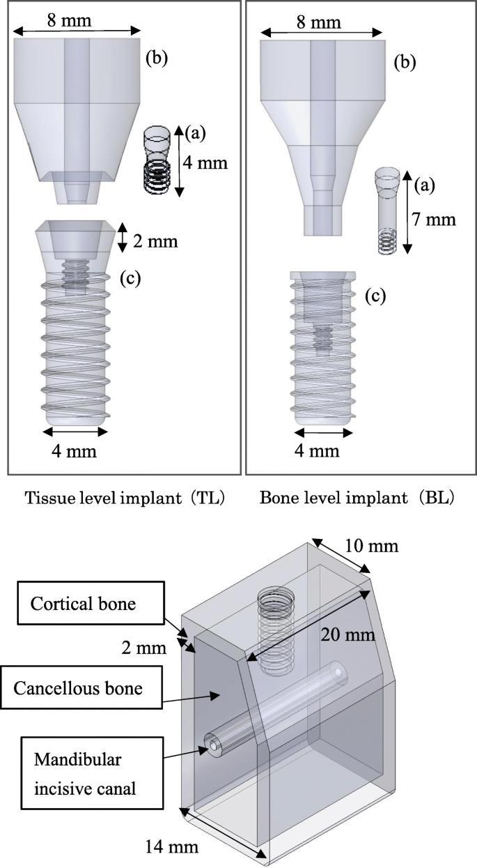 Fig. 1. Three-dimensional CAD model. (upper: a abutment screw, b superstructure, c implant body; Lower: bone model)