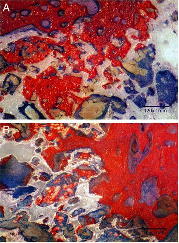 Fig. 2. zirconia scaffold (black arrow). Unmineralized bone stained blue. Almost entire surface porosity was filled with new dense bone. b Histological section demonstrating bone growth in HA-enriched zirconia scaffold starting from the periphery of the surgical wound (white arrow). Islands of entrapped HA particles were surrounded by mineralized boney matrix (black arrow) which were identified using EDX