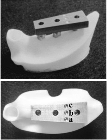 Fig. 4. Experimental model. (a) Buccal load, (b) central load, and (c) lingual load
