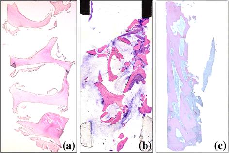 Fig. 4. Histological samples. a CCXBB control without implantation. b Histologic samples with acute inflammatory infiltration. c Histologic sample with limited remaining CCXBB and large bone ingrowth