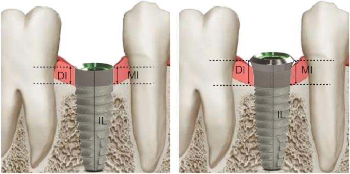 Fig. 4. Schematic view of radiographic measurement references