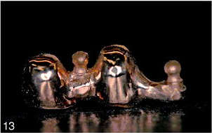 Figure 13. A platinum-palladium-gold (type IV) alloy framework of the mesobar consisted of 2 abutment copings with 2 male protruding components of the O-ring system.