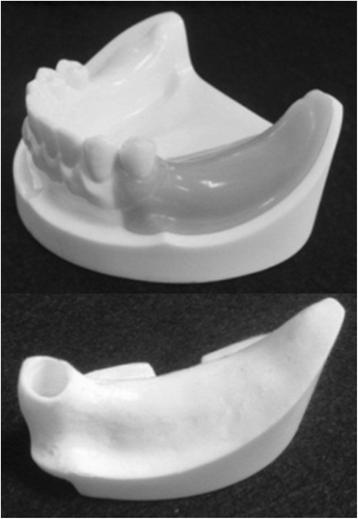 Figure 1. An artificial mandible.