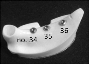 Figure 2. Three implants were embedded in an artificial mandible.