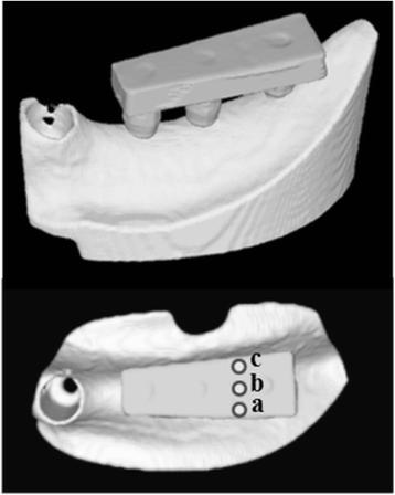Figure 5. An FEA model. (a) Buccal loading, (b) central loading, and (c) lingual loading are shown.