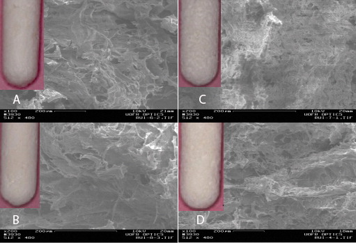 Macroscopic and scanning electron microscopy views of the prototype collagen-hydroxyapatite (Col-HA) composites. (a) Pure type I collagen without HA. (b) 80%Col-20%HA composite. (c) 50%Col-50%HA composite. (d) 20%Col-80%HA composite.