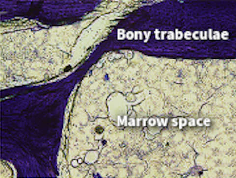 Trabecular bone